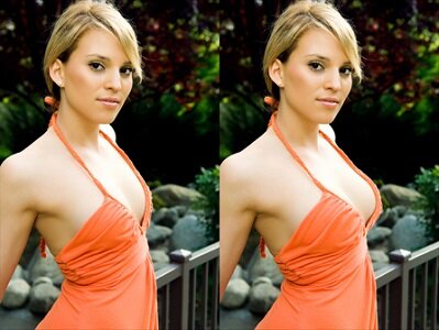 breast enlargement